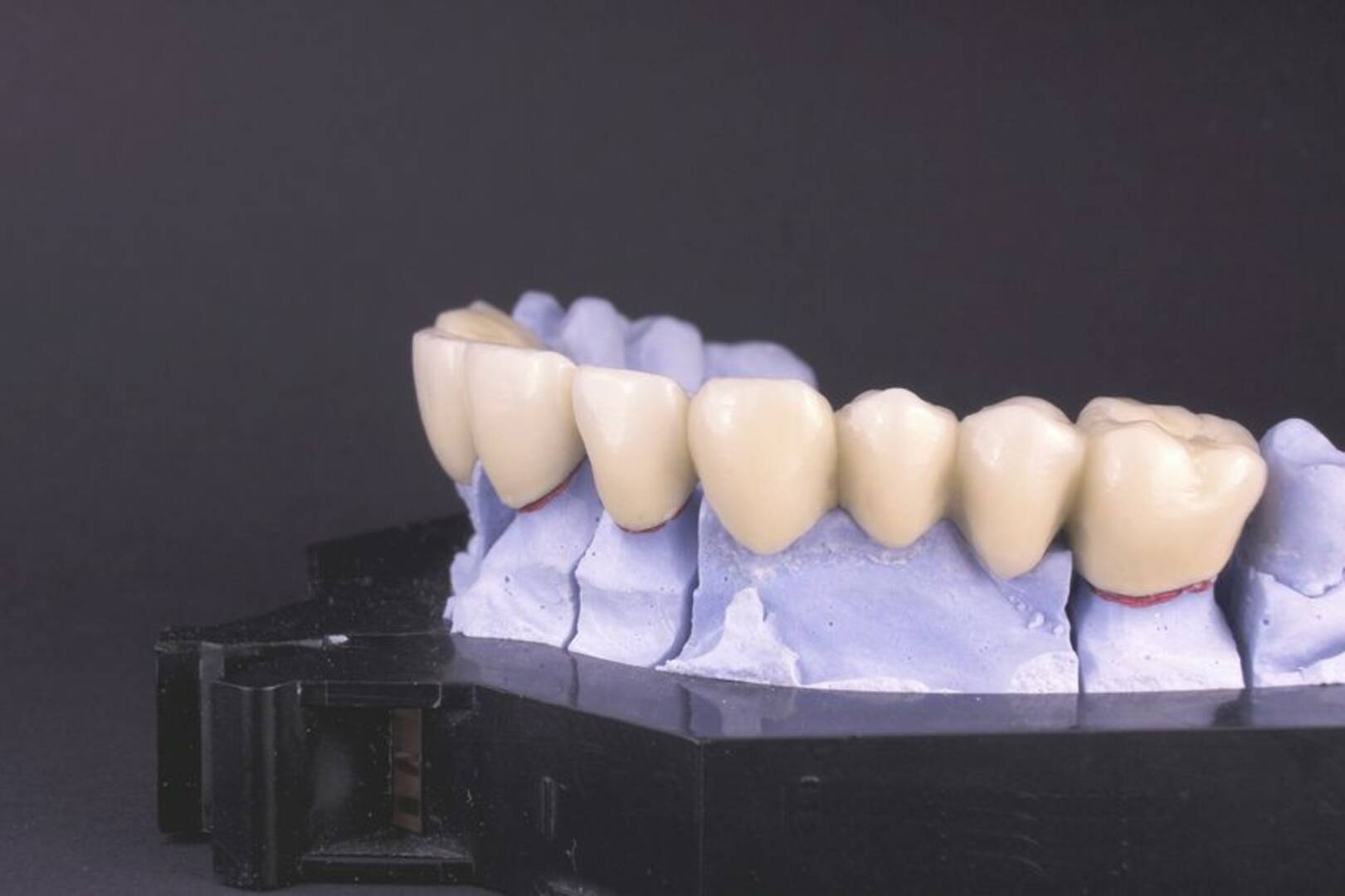 Dental Care Parker CO